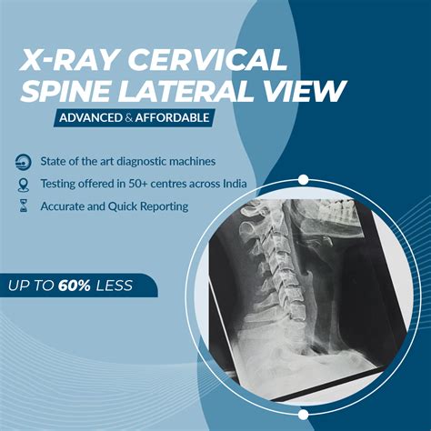 Cervical Spine Lateral View X-ray - Aarthi Scans and Labs