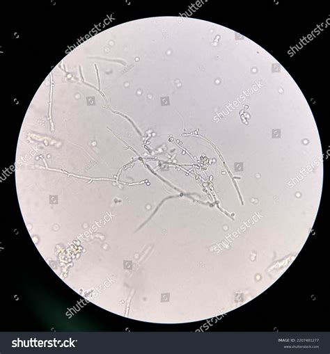 749 Yeast Urine Images, Stock Photos & Vectors | Shutterstock
