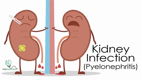 Heat On Kidneys For An Infection at Steven Peraza blog