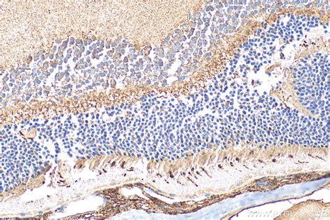 OPN1SW antibody (24660-1-AP) | Proteintech