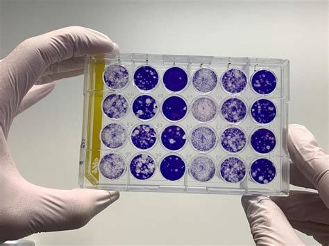 Neutralization Test 的图像结果