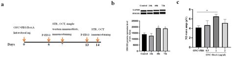 High-Mobility Group Box 1 Inhibitor BoxA Alleviates Neuroinflammation ...