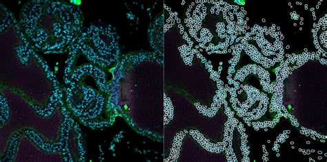 ImageJ Colocalization Analysis 的图像结果