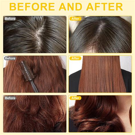 N Nexoria Hair Vitamin Serum Capsule, Hair Care Capsules Hair India | Ubuy