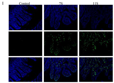 Soybean Antigen Protein-Induced Intestinal Barrier Damage by Trigging ...