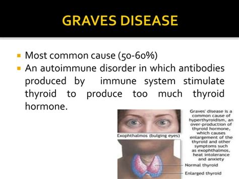 Image result for hyperthyroidism