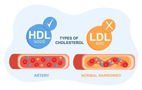 Image result for HDL Components Code
