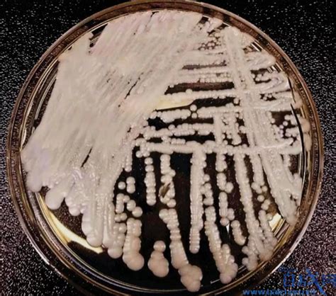 美国多地爆发超级真菌，致死率高达60%_国际新闻_百战网