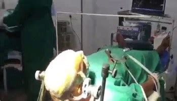पेशेंट देखता रहा बिग बॉस और अवतार, डॉक्टर ने कर दी सफल ब्रेन सर्जरी ...