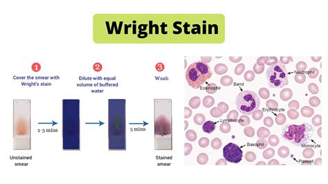 Hematoxylin and Eosin (H&E) Staining - Principle, Procedure, Result ...