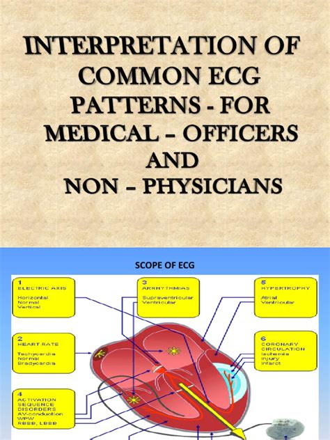 Image result for ECG Machine Tutorial