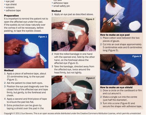 How To Place Plastic Eye Shield at Ila Yeomans blog