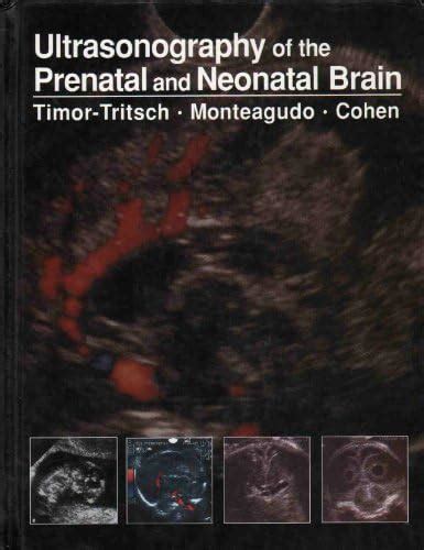 Buy Ultrasonography of the Prenatal and Neonatal Brain Book Online at ...