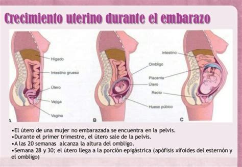 Como peditos o si bb estuviera haciendo caquita del.lado.izq. justo ...
