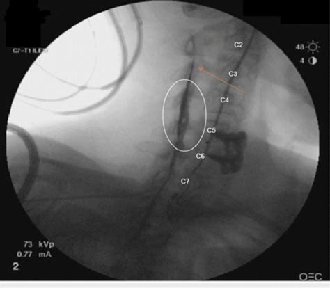 Image result for Contralateral View