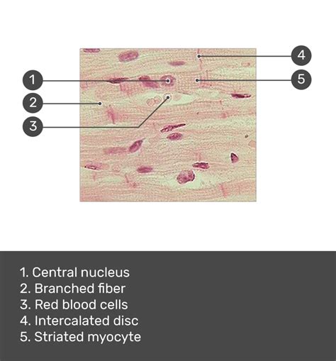 Image result for Cardiac Muscle Labelled Diagram