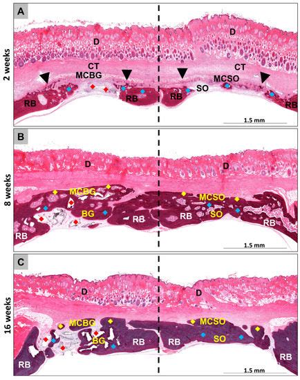 Analyses of the Cellular Interactions between the Ossification of ...