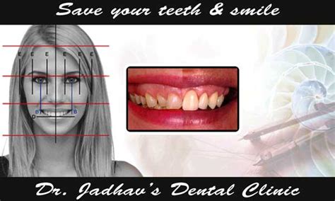 Dental Clinic in Ch. Sambhajinagar(Aurangabad) | Affordable Dental Care ...