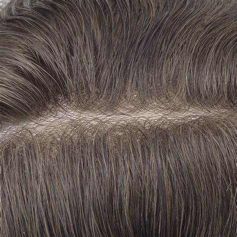 What Are the 7 Most Undetectable Hair Systems for Men 2025?
