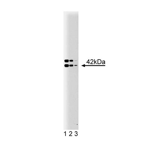 Purified Mouse Anti-B2 Bradykinin Receptor