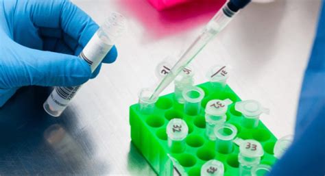 RNA Extraction [Free eBook]