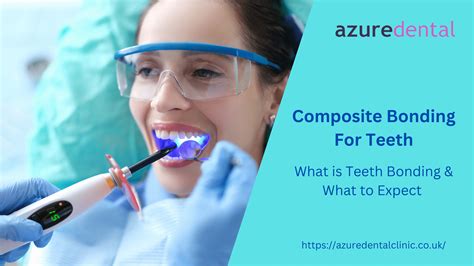 Composite Bonding For Teeth: What Is Teeth Bonding & What To Expect ...