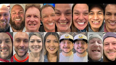 Bionic Smile (Bionicsmilelasvegas) - Profile | Pinterest