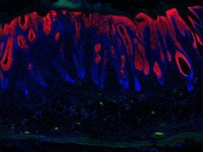 Image result for Partial Reprogramming