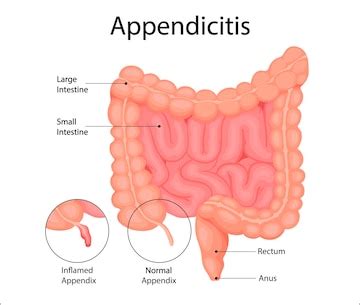 Image result for Appendix Example Website