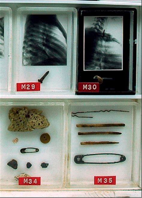 Alien Stomach Experiment Surgery 的图像结果