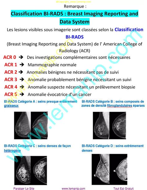 Biopsie Mammaire Stéréotaxique Radiologie Spécialisés