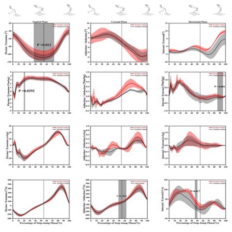 Statistical Parametric Mapping 的图像结果