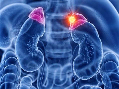 Adrenal Gland Cancer: Symptoms, Treatment, and More