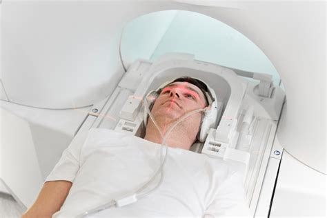 CT Scan Example 的图像结果