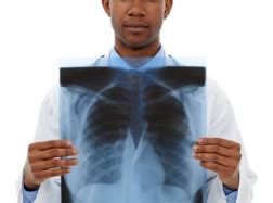 Image result for Normal X-ray