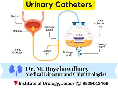 Fosfomycin in UTI Management: Its Role in Multi-Drug-Resistant Infections