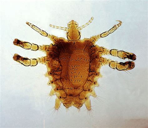 Sexually transmitted disease (STD) | Britannica