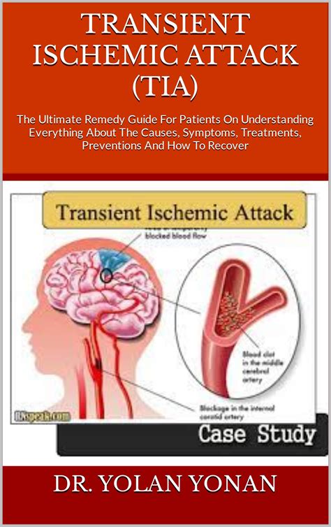 TRANSIENT ISCHEMIC ATTACK (TIA) : The Ultimate Remedy Guide For Patients On Understanding ...