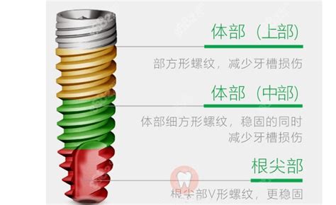 德国卡瓦abt种植体怎么样？先了解价格多少钱以及材料优势,种植牙-8682赴韩整形网