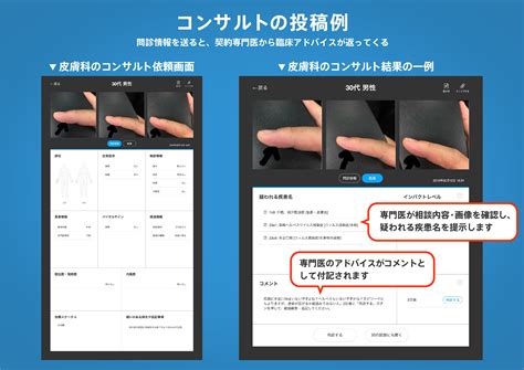 プロトン密度脂肪画分（PDFF）推定の複雑な再構築を伴う高SNR化学シフトエンコードMRIの評価全体および低脂肪範囲の評価 - Bibgraph（ビブグラフ）| PubMedを日本語で論文検索