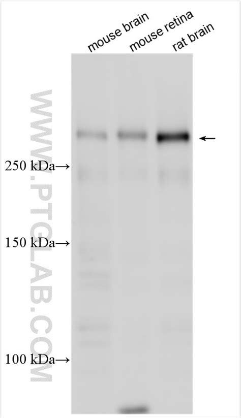UNC79 antibody (31426-1-AP) | Proteintech