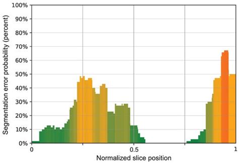 Reliability of Automated Intracranial Volume Measurements by Synthetic ...
