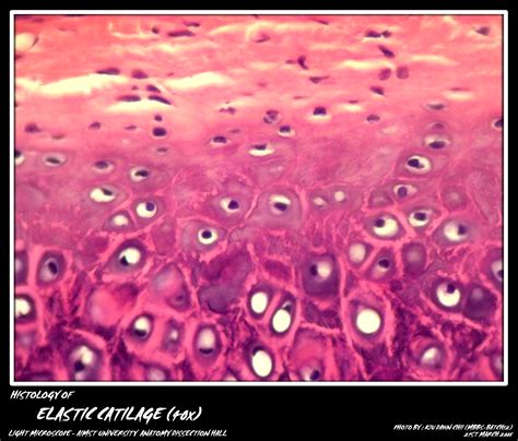 Elastic Cartilage Under Microscope