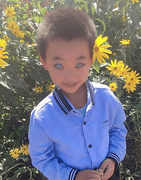 8岁男孩长了一双浅蓝色的眼睛, 最大的愿望却是能够亲眼看看家人
