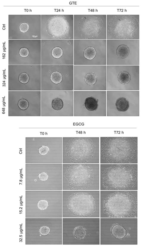 Comparative Anticancer Potential of Green Tea Extract and ...