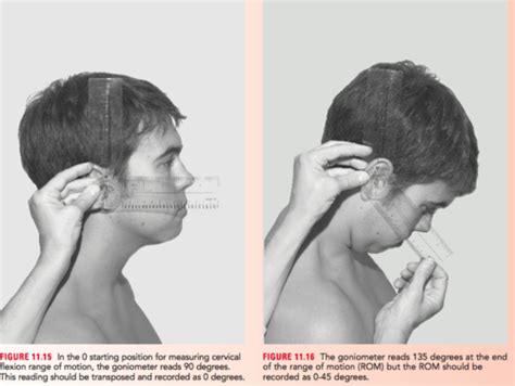 Image result for Cervical Rotation Goniometry