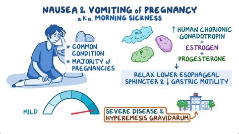 Nausea and vomiting of pregnancy: Clinical sciences - Osmosis Video Library