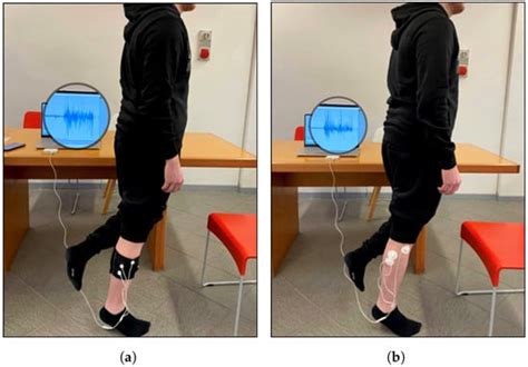 Measuring Surface Electromyography with Textile Electrodes in a Smart ...