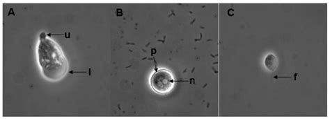Naegleria Fowleri Cyst