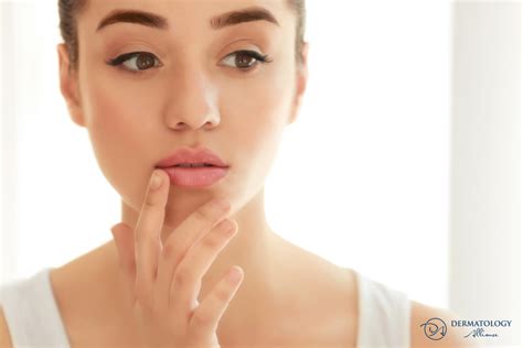 Image result for Pimple From Dry Lips